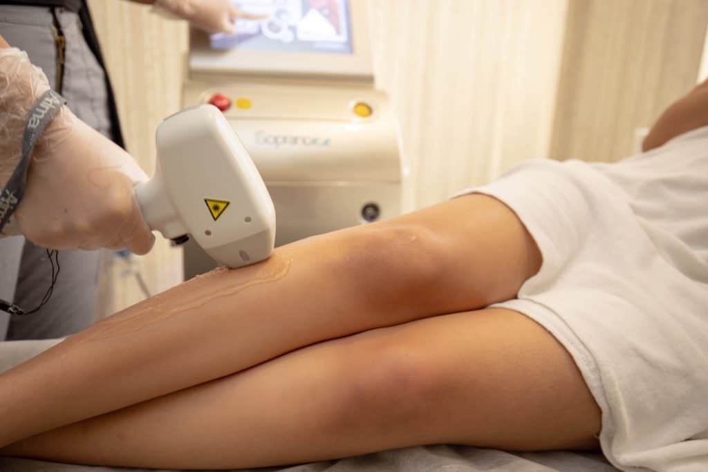 AT HOME LASER HAIR REMOVAL - ANSWERING ALL OF YOUR QUESTIONS!